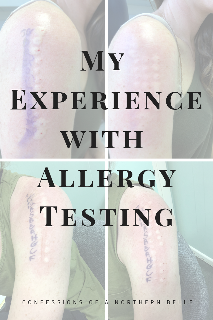 Allergy Testing Results - Experience 